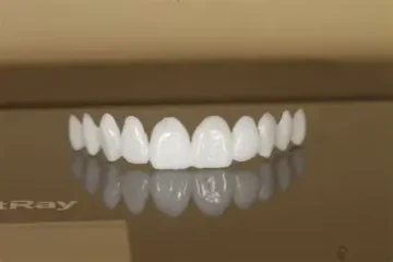 A set of white dental veneers or artificial teeth, including 3D Printed Veneers, is displayed on a reflective surface, showcasing both the teeth and their clear reflection beneath.